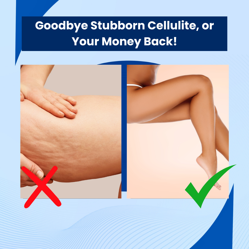 CelluShift™ - Cellulite-Behandlung