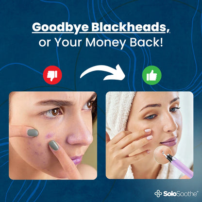 DeepDerm™ - Blackhead Remover