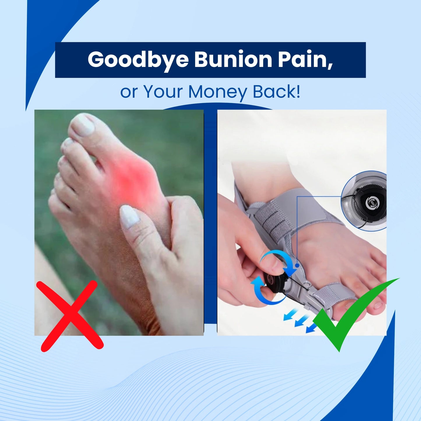 BunionAlign™ Bunion Corrector + 3 FREE Gifts Today