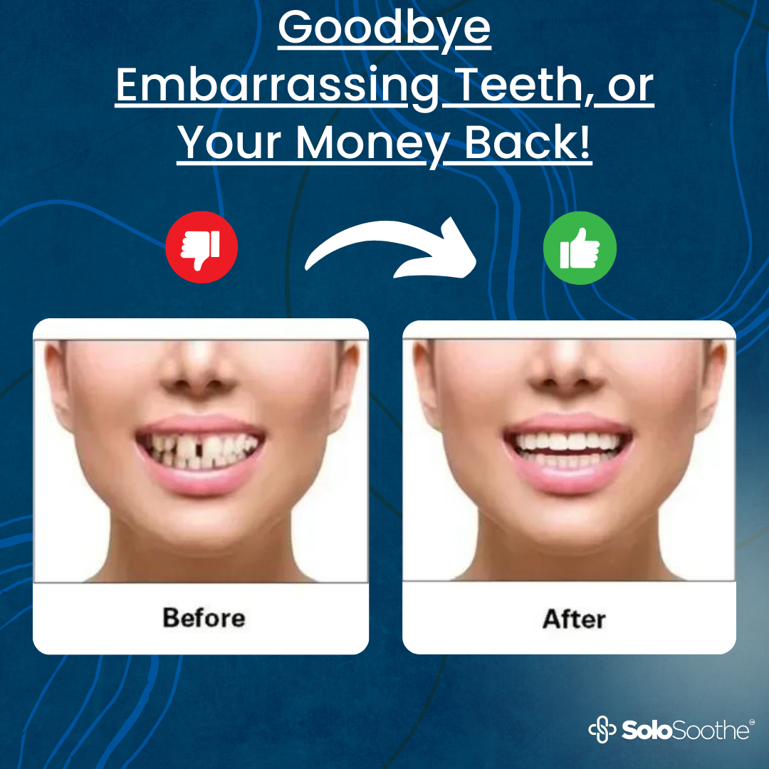 RadiantSmile Veneers