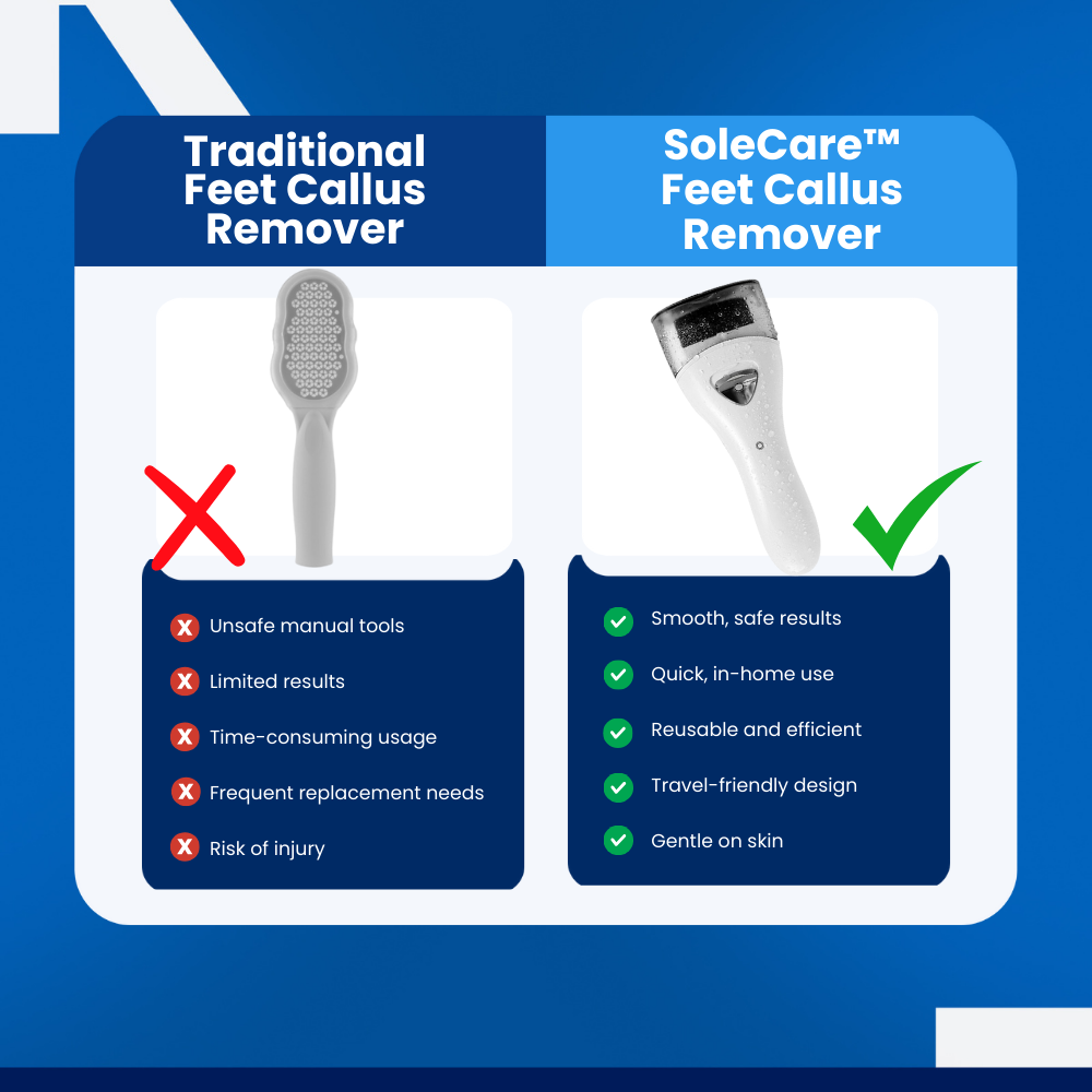 SoleCare™ - Feet Callus Remover