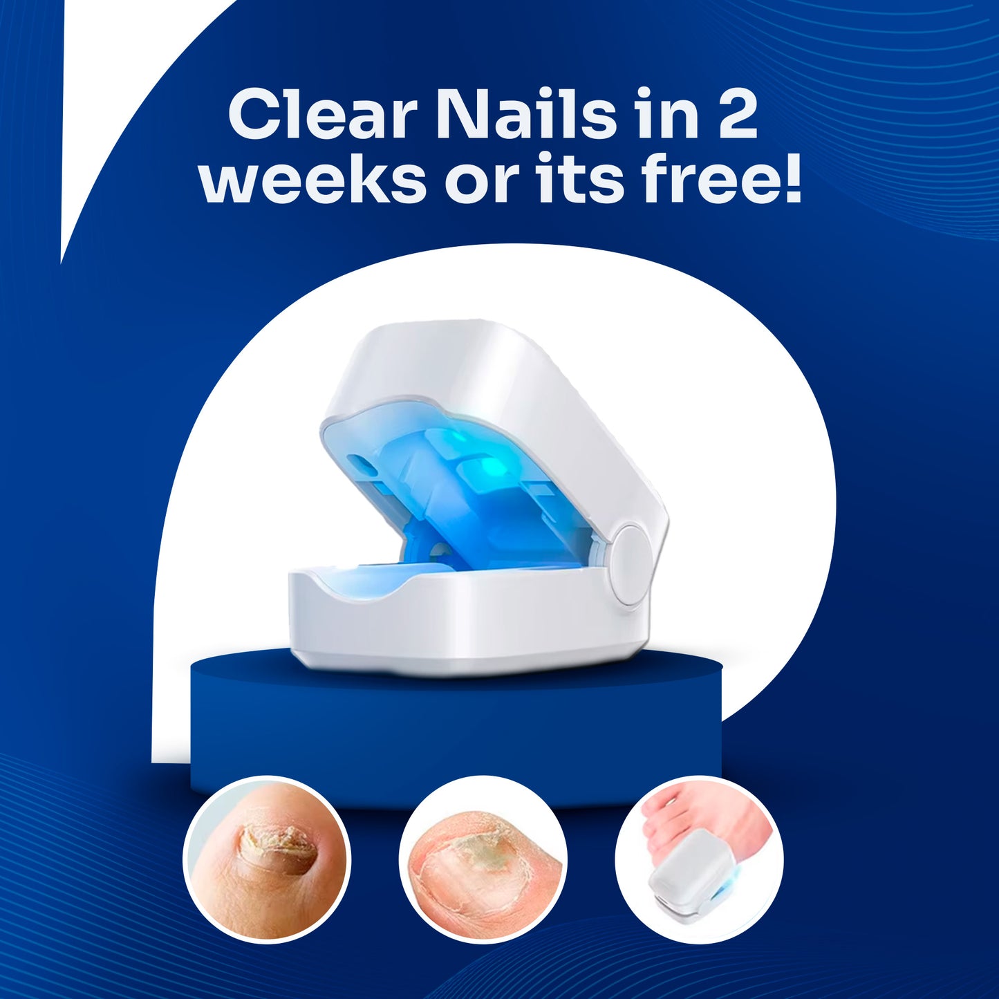 DermalPulse®️ Nail Fungus Treatment