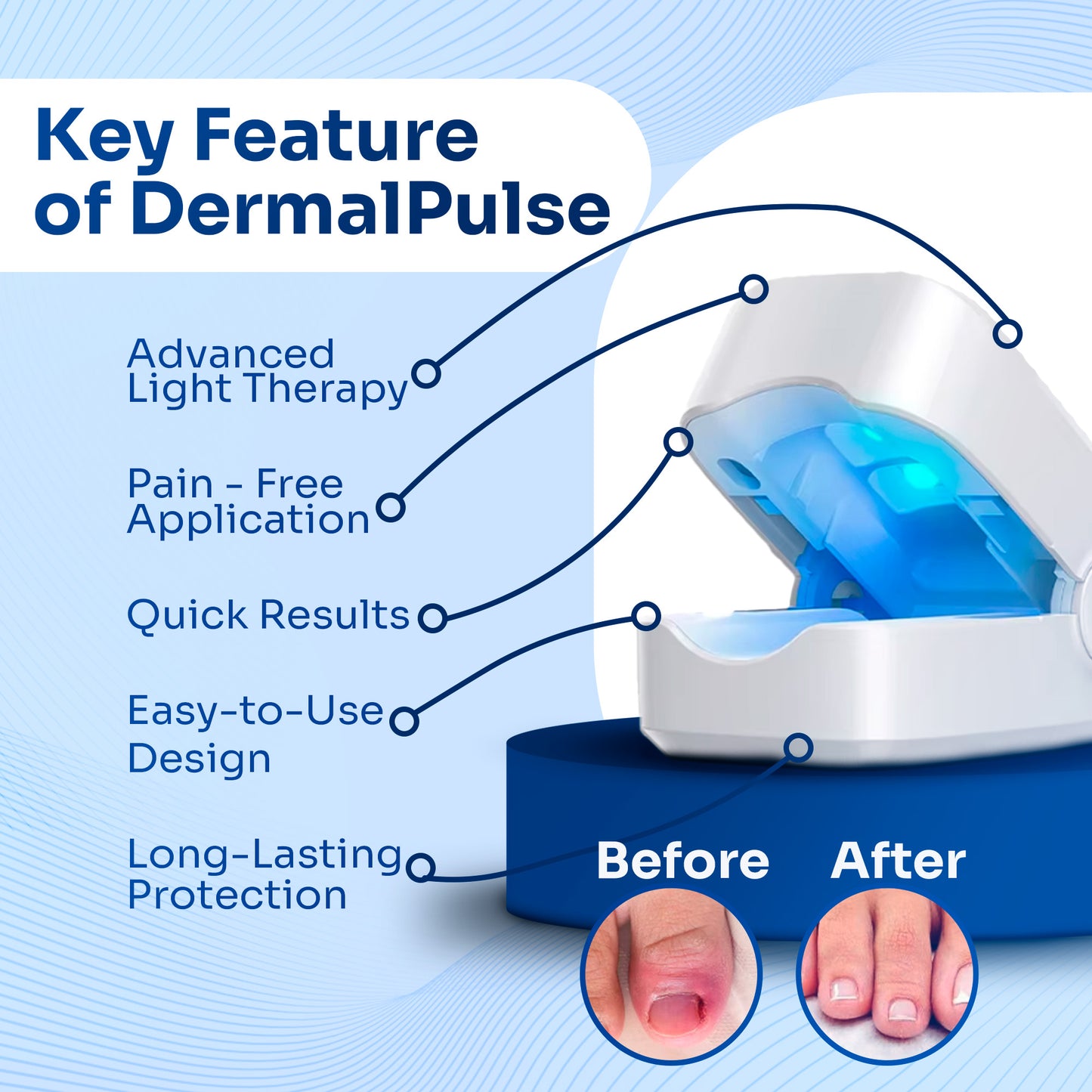 DermalPulse®️ Nail Fungus Treatment