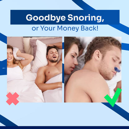 SnoreGuard Elite - Anti Snore Device