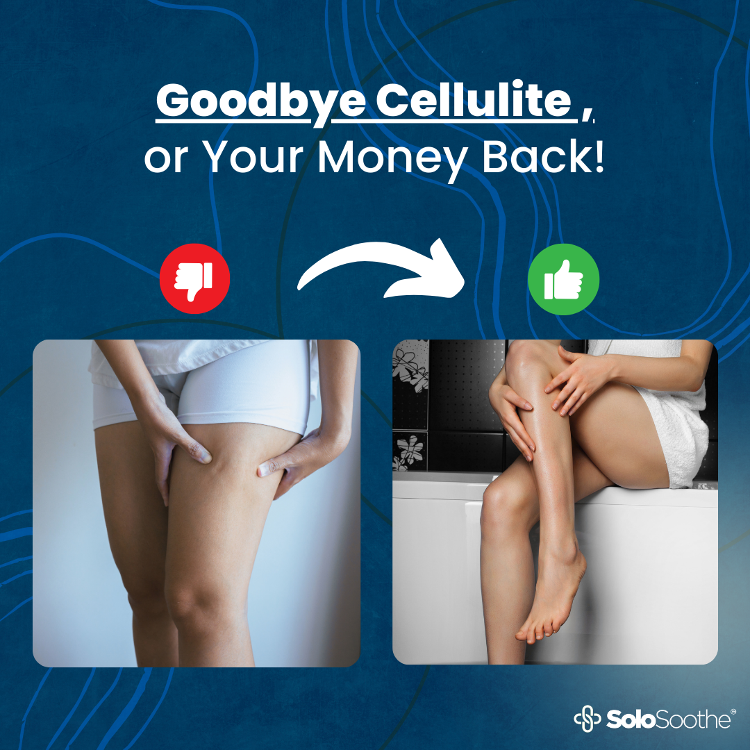 CelluErase™ - Cellulite Treatment