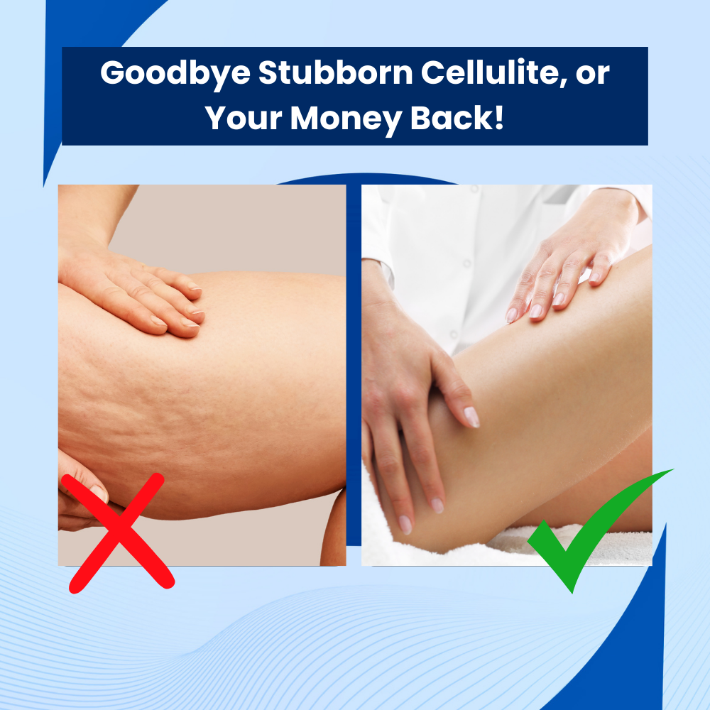 SkinFusion Pro™ - Cellulite Treatment