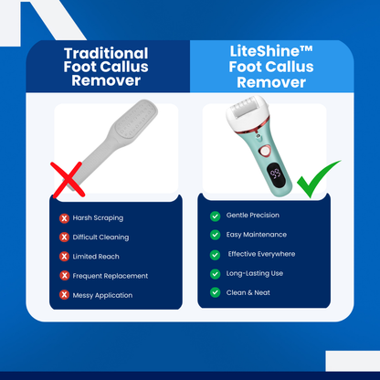 LiteShine™ - Foot Callus Remover