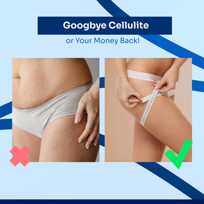 LipoWave Activator™ Cellulite Massager