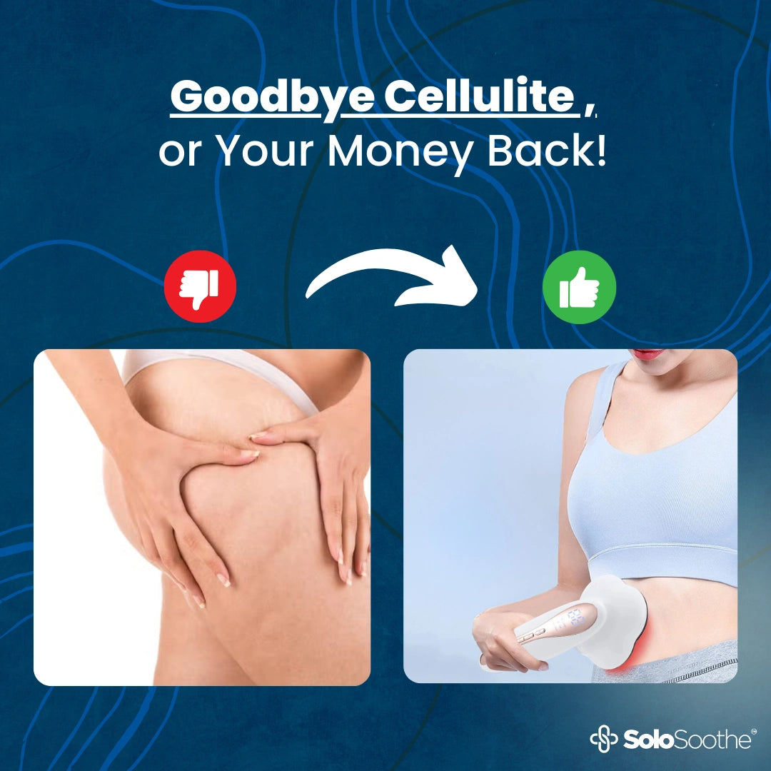 LipoFlex™ - Cellulite Treatment