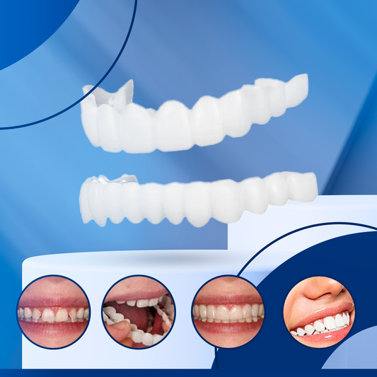 RadiantSmile™ Veneers