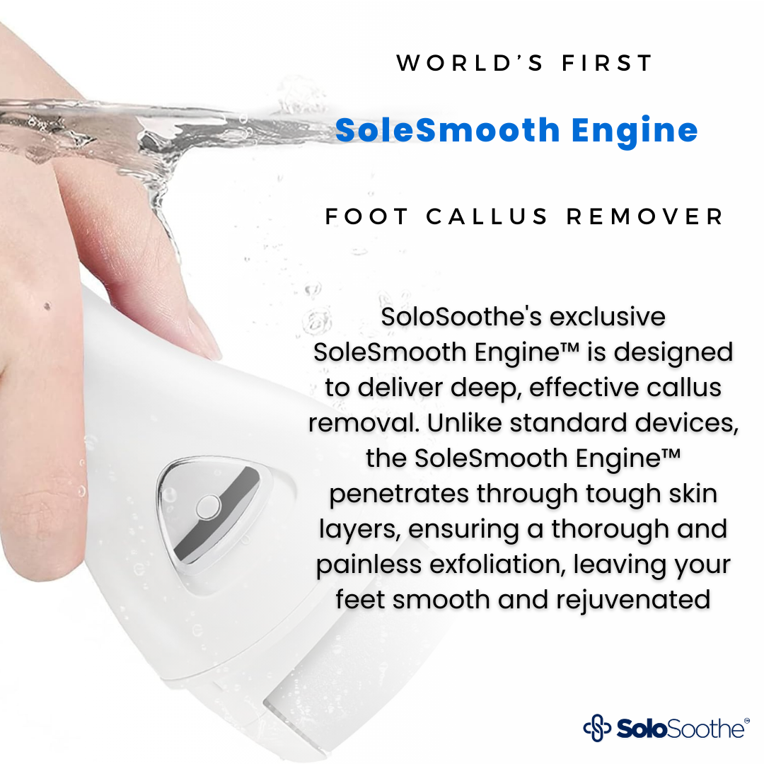 SmoothGlide™ Callus Remover