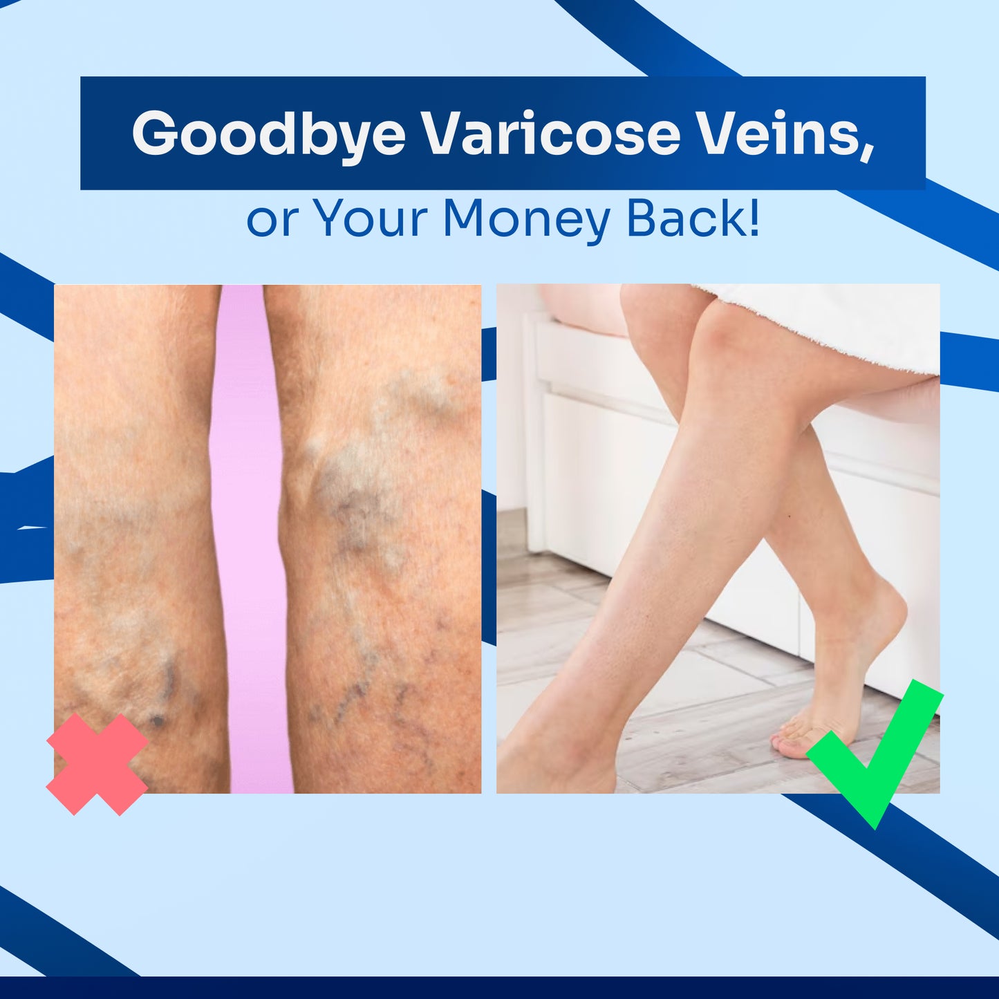 Vein Vanisher Cream ®