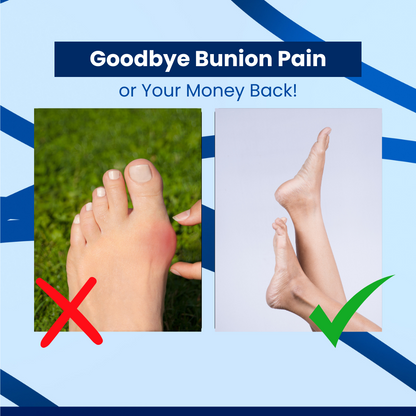 ComfortStride™ Bunion Corrector